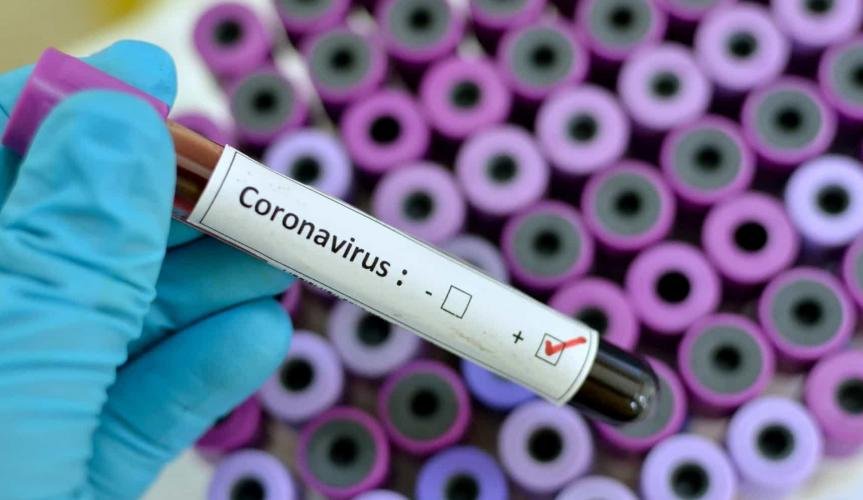 Sesma investiga possível 1º caso de coronavírus em Belém